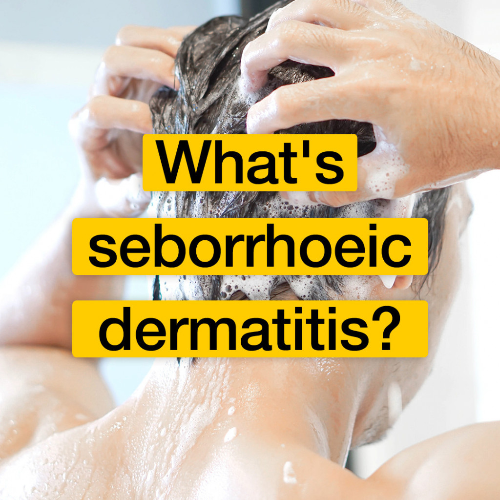 What's seborrhoeic dematitis?
