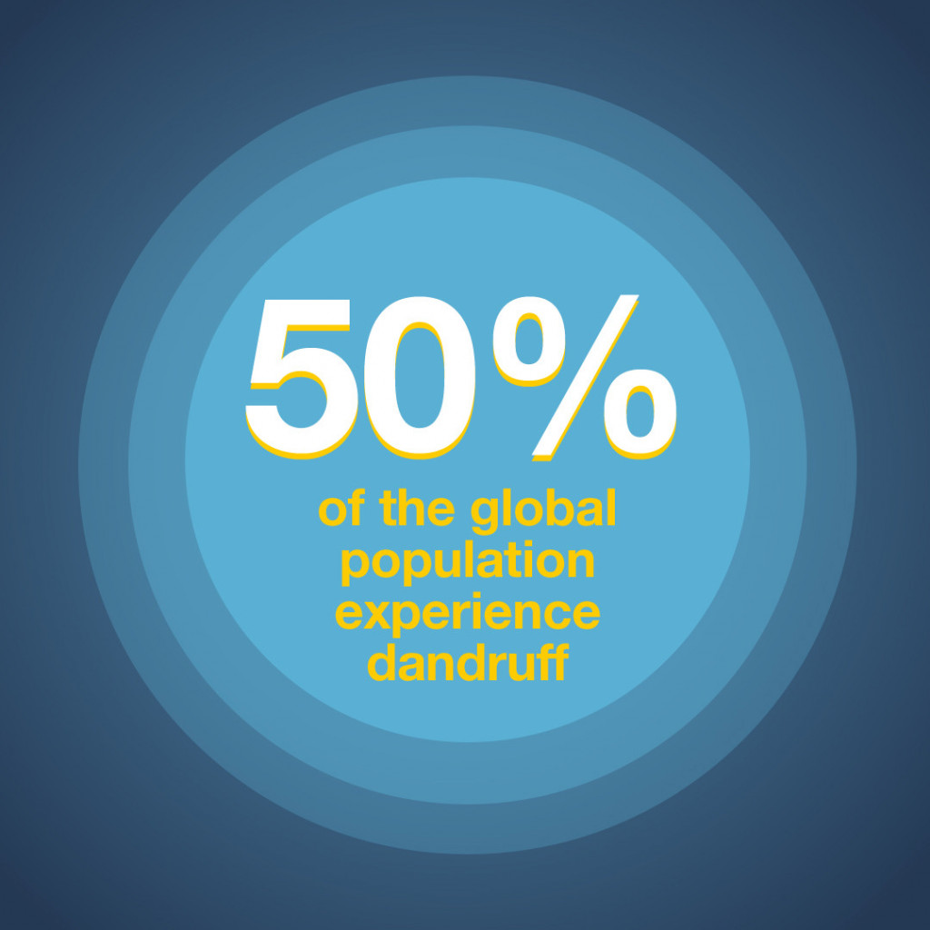 50% of the global population experience dandruff