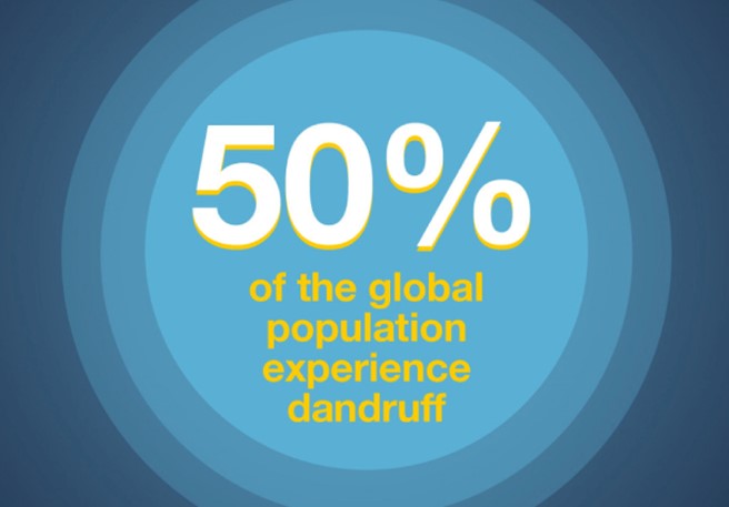Extreme dandruff can have several causes